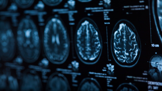 neurology x-rays