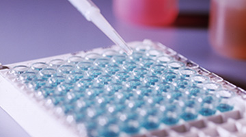 Retrovirology & TB Laboratories - Mali