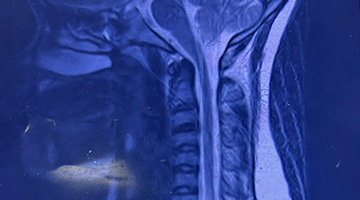 photo of a head and neck xray